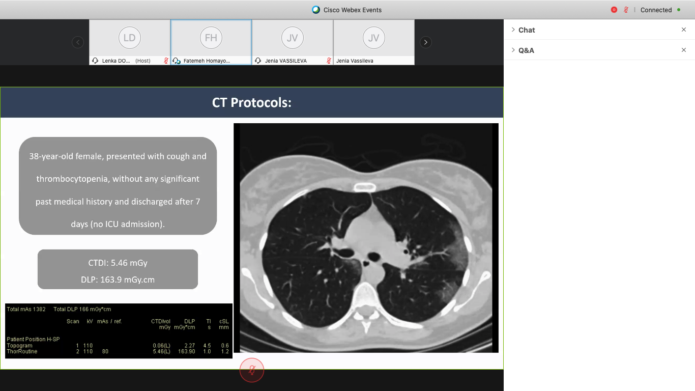 CT indications;