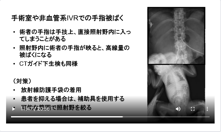 トリミングされていない例