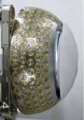 gamma_knife_head γ‐ナイフ