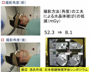 otolaryngology_CT