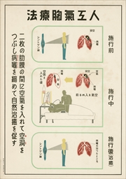 正しい療養誤った療養